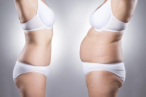 A woman's body before and after usage of herbal belly slimming patches