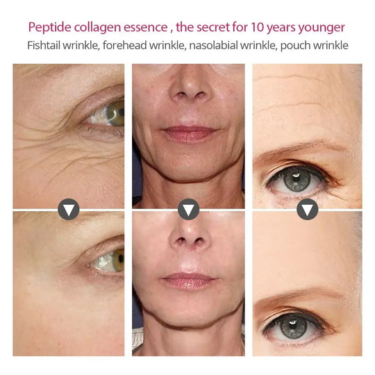 Before and after application of Collagen Peptides Facial Serum-dissapearance os wrinkles around eyes and mouse