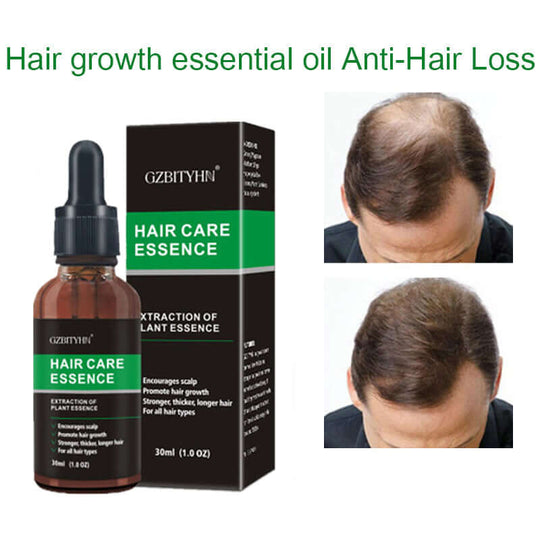 A bottle and a box of ginseng and ginger hair growth oil - before and after usage on man's head