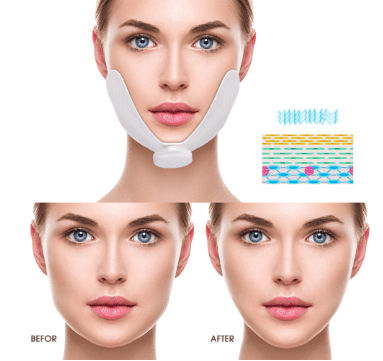  A woman's wearing a facial slimming and sculpting massager and her face before and after its usage 