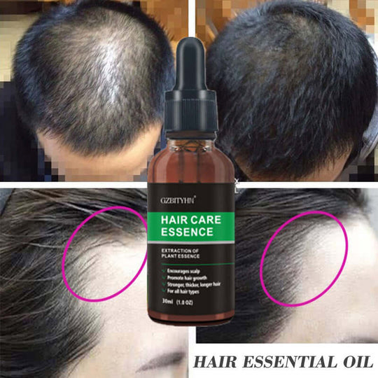 A woman's and mans heads before and after usage of ginseng and ginger hair growth oil  