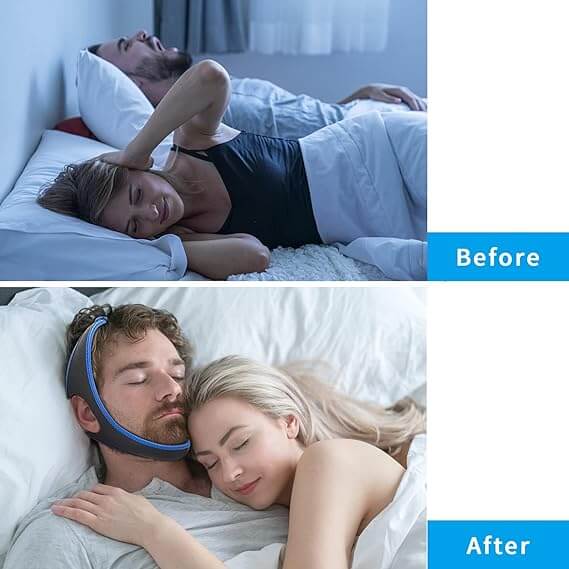 Anti-snoring jaw strap - before and after usage