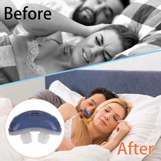 Before and after using of anti-snoring device