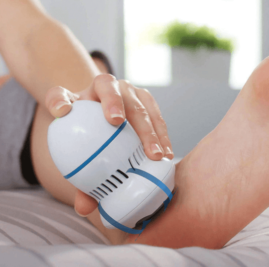 Electric Vacuum  Callus Remover in action