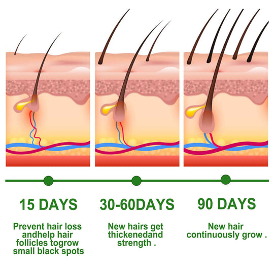 Hair growth after  15, 30 and 90 days of rosemary essential oil usage