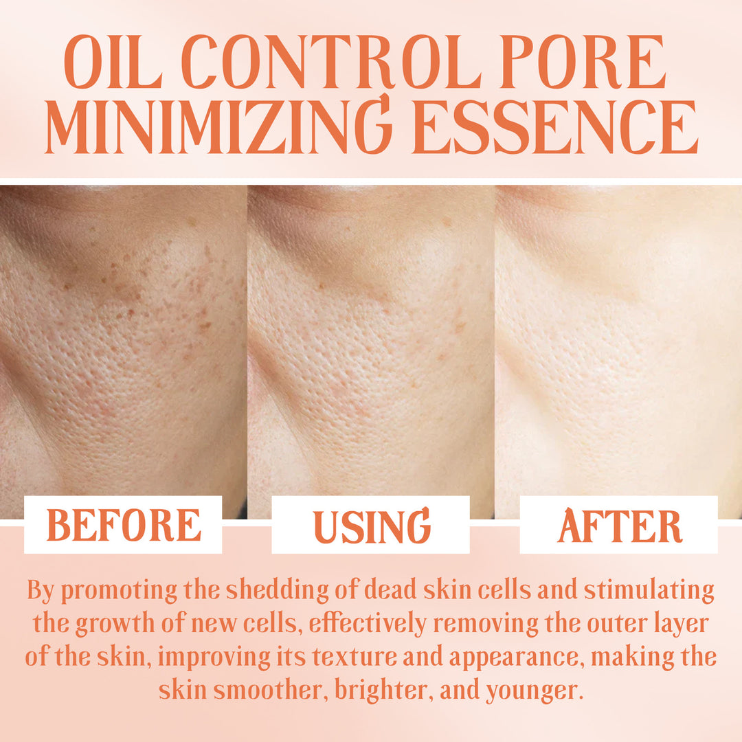 Ouhoe Oil Control Pore Minimizing Serum