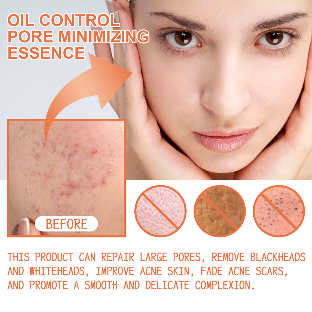 Ouhoe Oil Control Pore Minimizing Serum