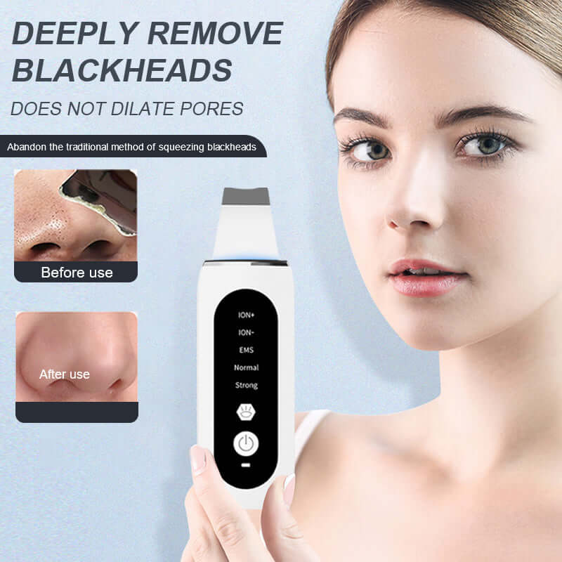 The ultrasonic skin scrubber can be used to remove blackheads 