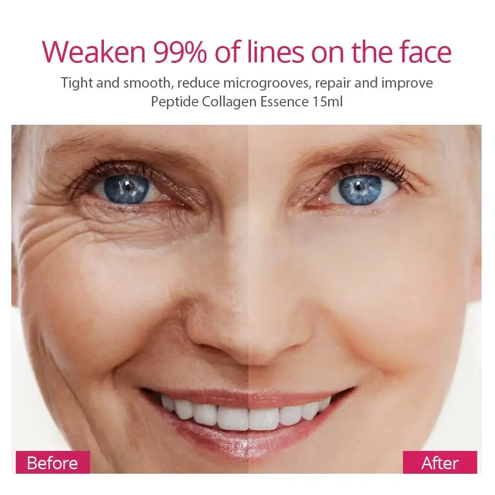 womwn's face befor and after usege of Collagen Peptides Facial Serum