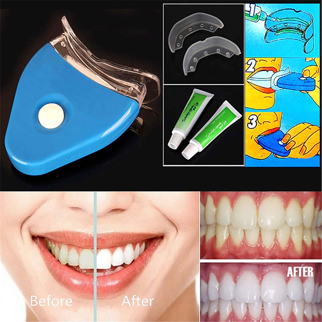 What is incuded, how to use it and before and aplication of whitesmile teeth whitening system