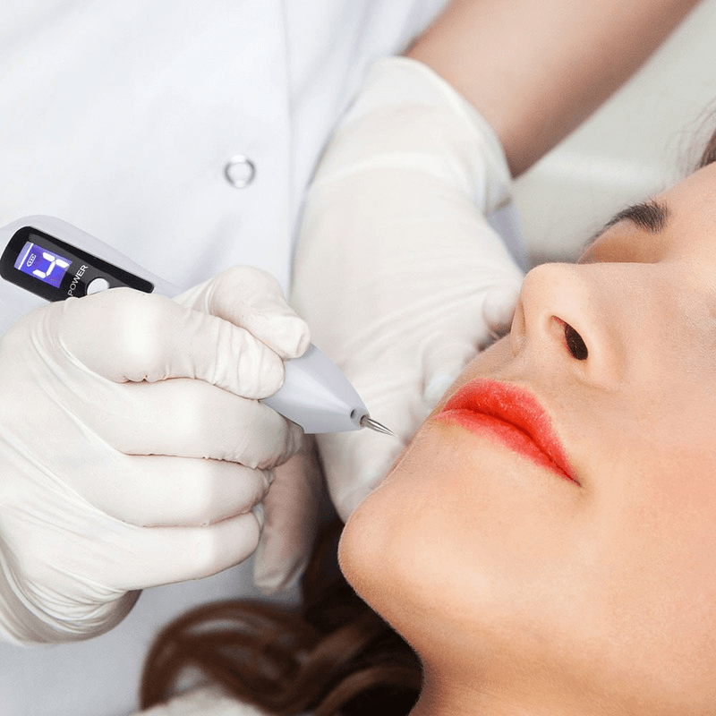 Beautician employing a 9-intensity levels blemish remover pen to enhance skin by removing imperfections from a woman's face.