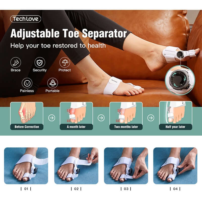 A big toe before and after wearing an adjustable bunion correctore for 1, 2 and 6 months. How to wear a bunion corrector - 4 steps explanations