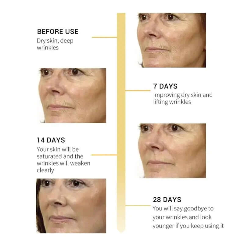 Before and after 7, 14 and 28 days use of Breylee retinol firming and lifting serum