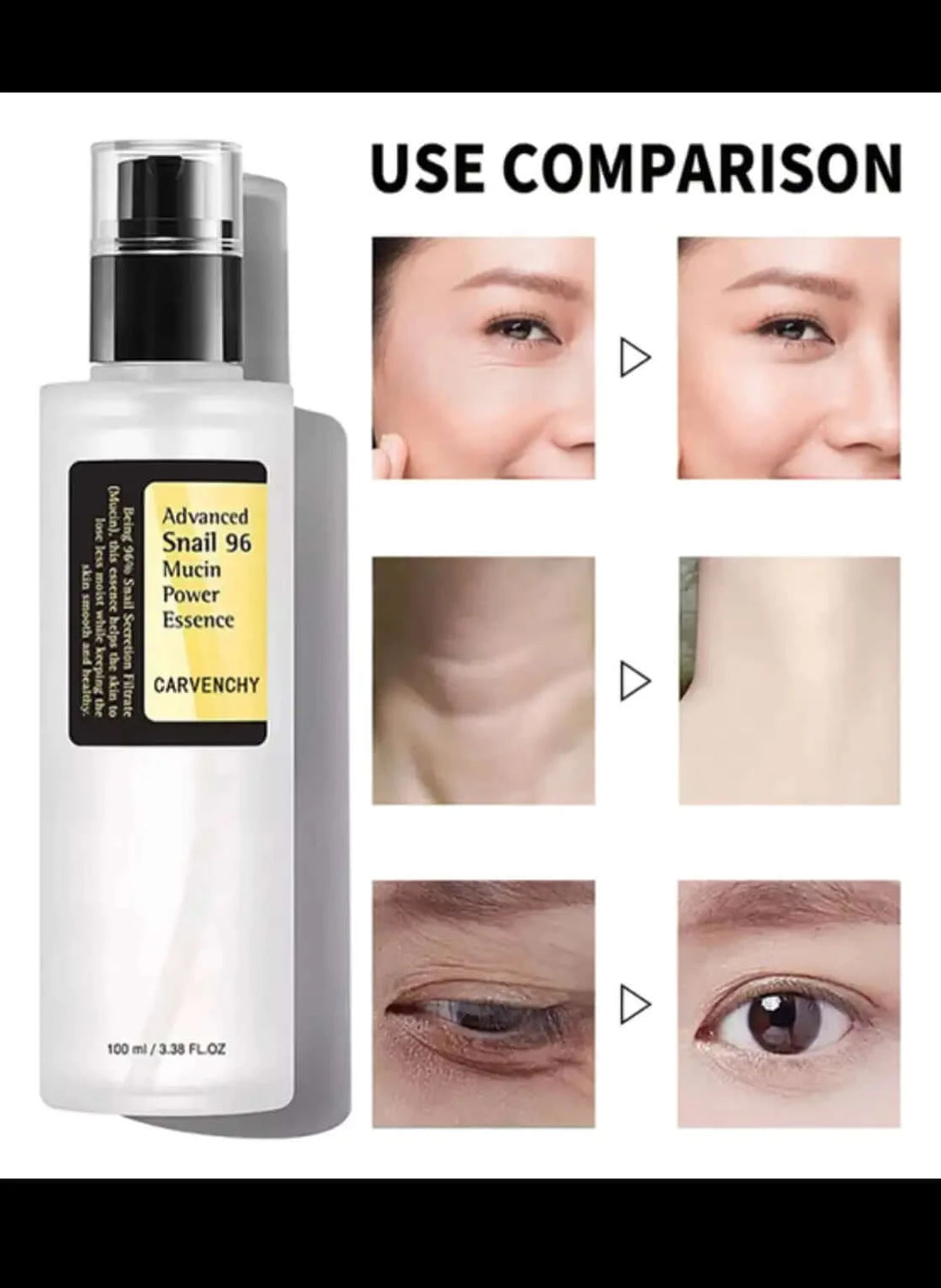 Before and after use of snail mucin 96 power repairing essence 