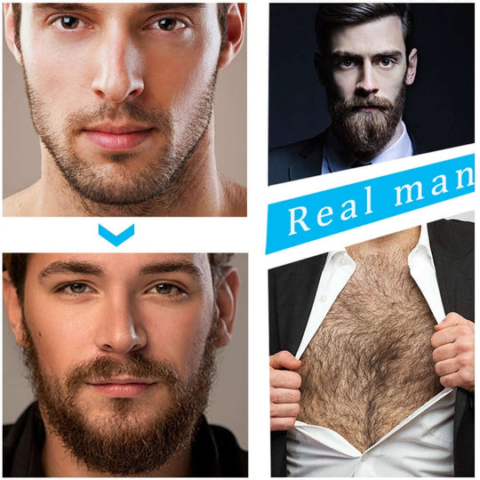 Before and after use of beard growth kit on man's beard and chest 