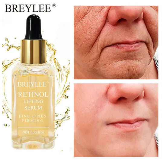 Before and after use of Breylee retinol firming and lifting serum on another woman's face