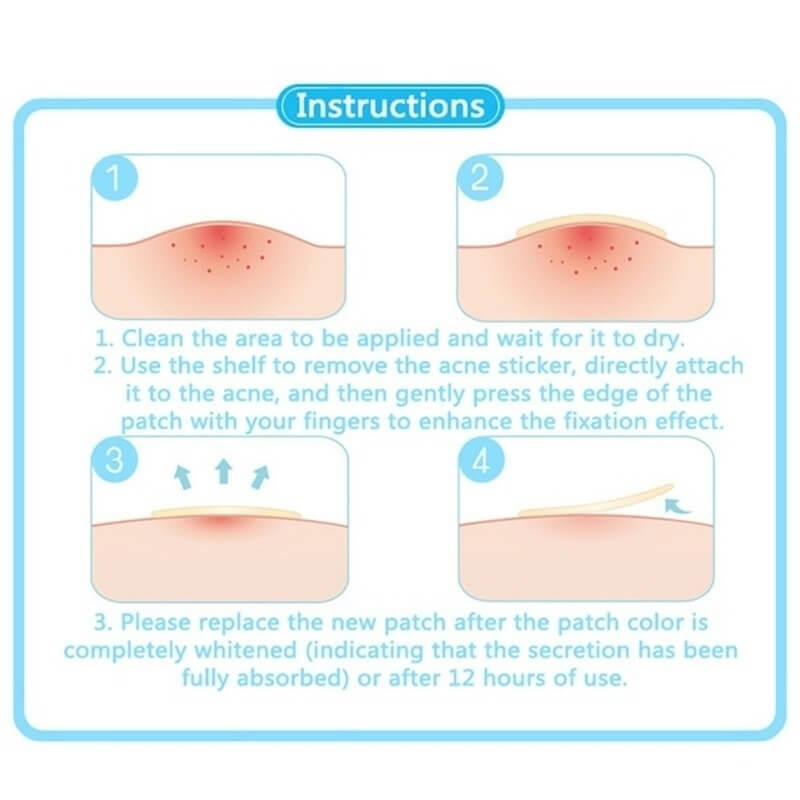 How to use acne removal patches 