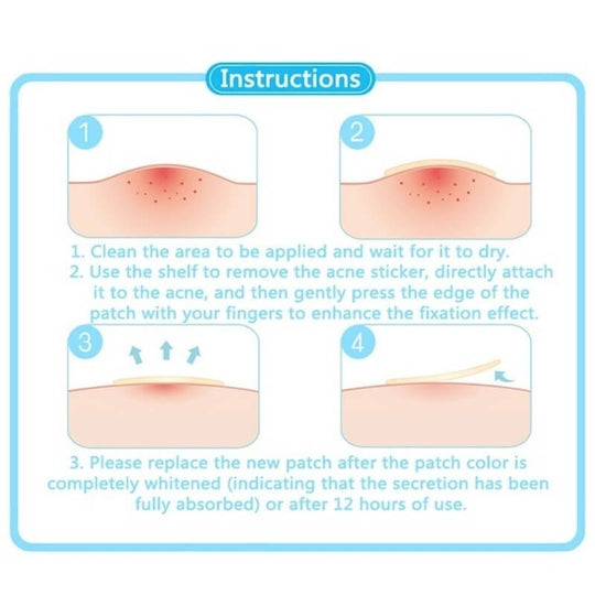 How to use acne removal patches 