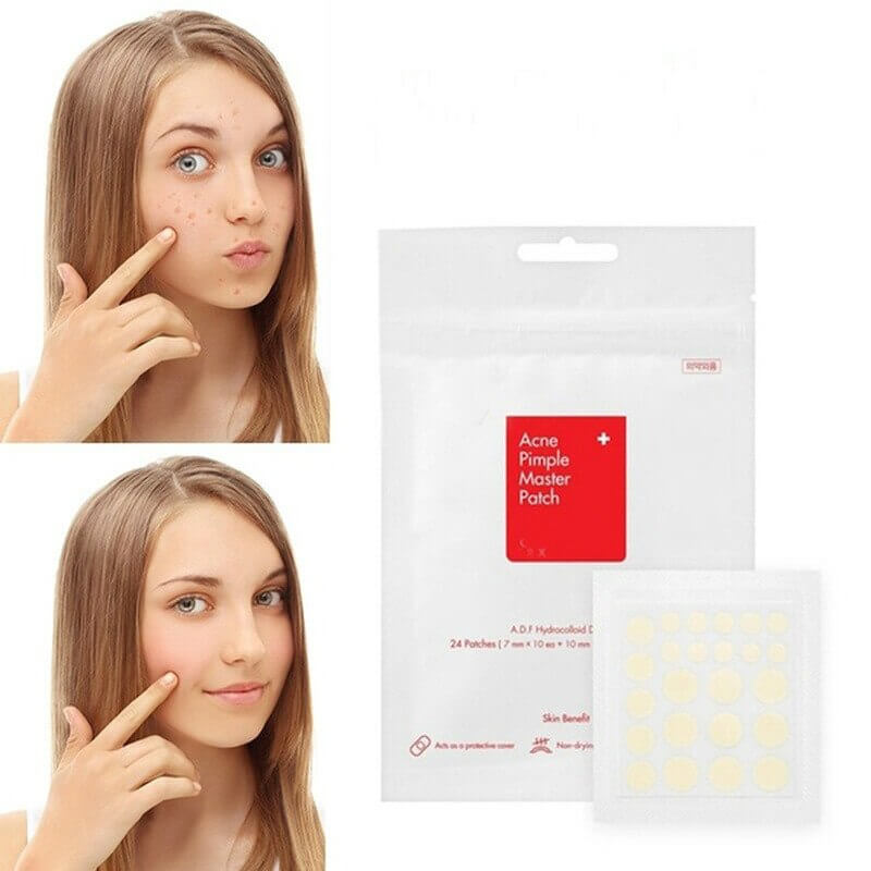 The face of a girl before and after use of acne removal patches