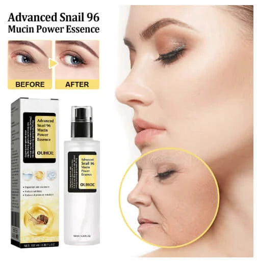 Before and after usage of snail mucin 96 power repairing essence 