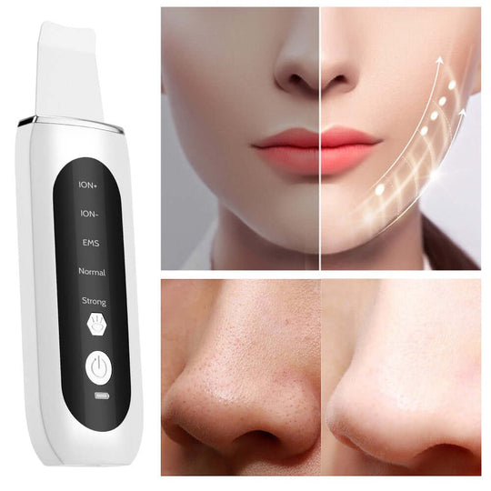 Ultrasonic skin scrubber and the face of a woman before and after its use