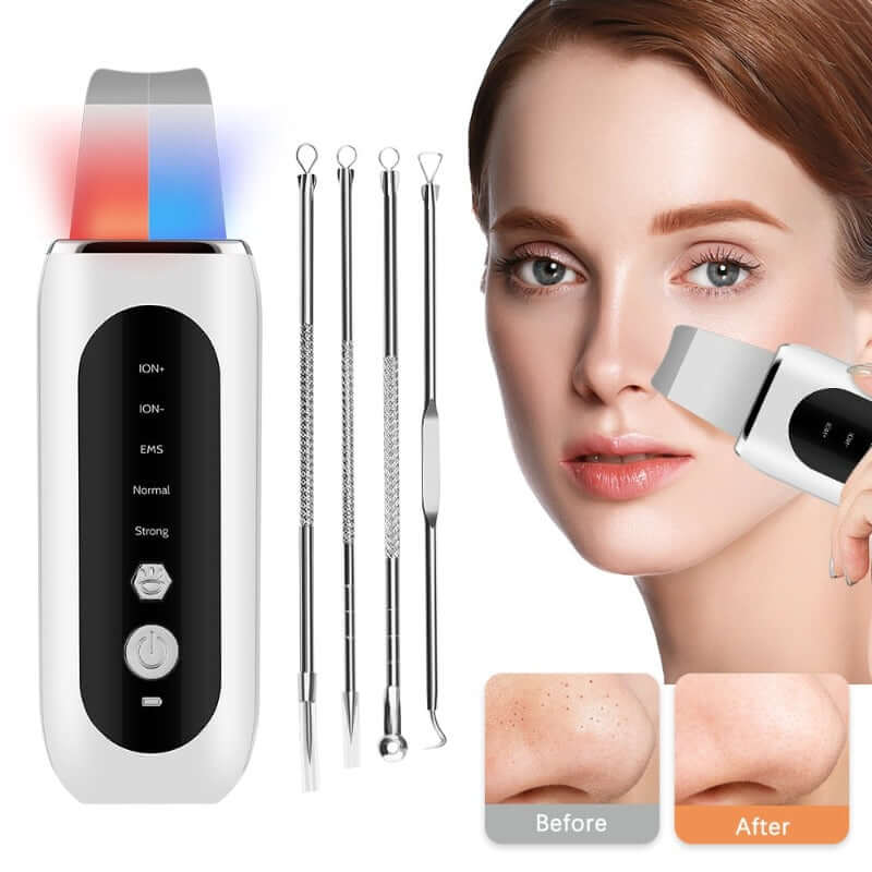 Ultrasonic Skin Scrubber plus 4 spare parts used for cleaning the face of a young woman